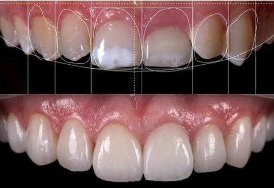 Cosmetic & Smile Design